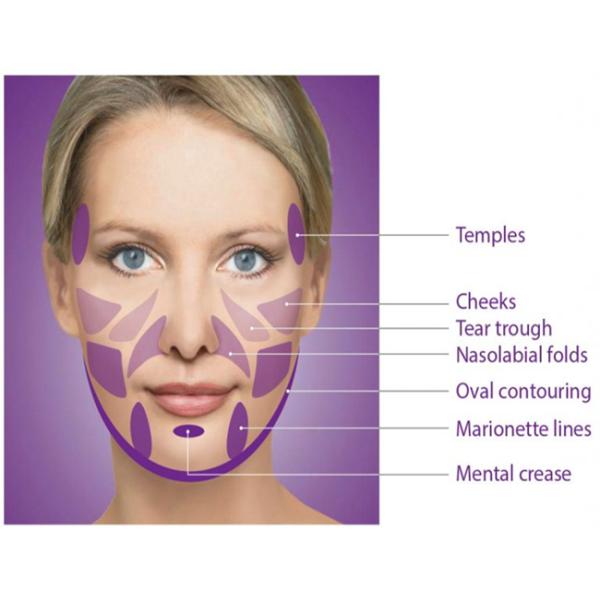 5 мл кожных наполнителей для лица PLLA коллаген Derma Filler для инъекций