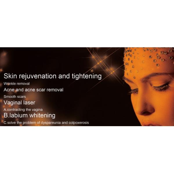 Professional Skin Tightening Machine , Laser Scar Removal Machine Aiming Beam Adjustable