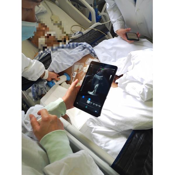 Efficient Handheld Ultrasound Probe For Critical Care Application
