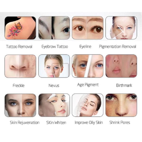 Super model new design 4 in 1 Nd Yag Tattoo Removal diode laser IPL skin rejuvenation beauty machine