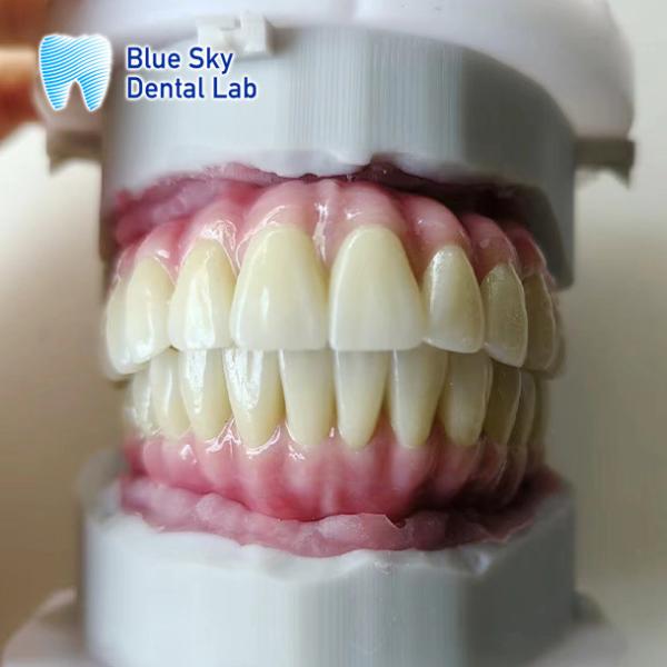 Cas d'implant de la bouche entière personnalisé Compatibilité universelle