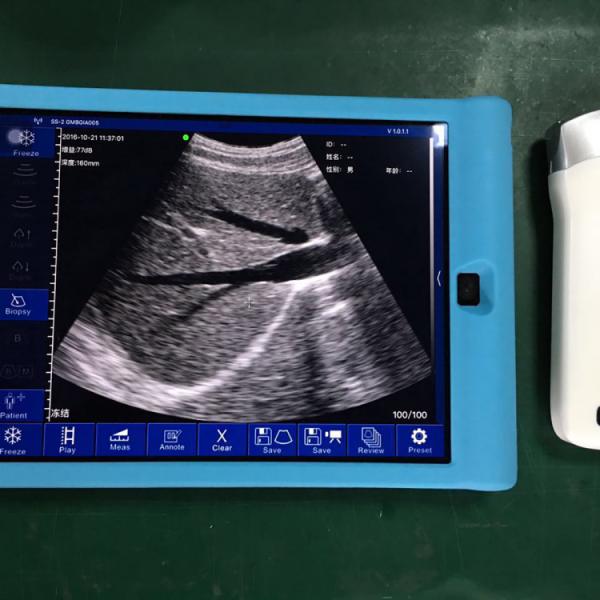 High Quality Medical Ultrasound  Handheld Wireless Mini Color Doppler Ultrasound Scanner