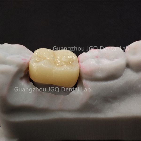 Custom Zirconia Restorations Professional Dental Lab for Global Dental Clinics