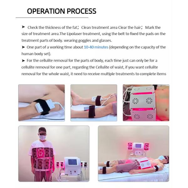 12 Pads 635nm 650nm Lipo Laser 100mW~350mW Fat Removal Fast Slimming Machine