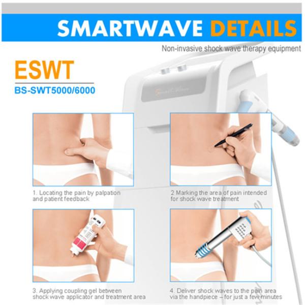 accurate 1-22Hz BS-SWT6000 eswl shock waves for Connective Tissue Pain and degeneration 