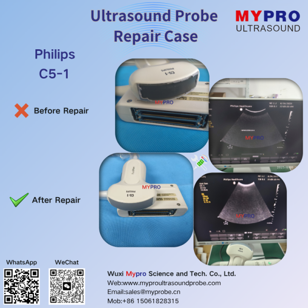 C5-1 Philips Ultrasound Probe Repair Service Crystal Scanhead Replacement