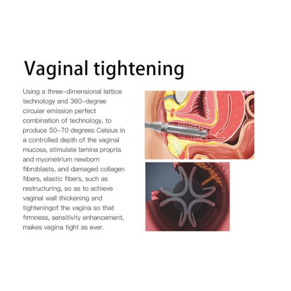 оборудование машины 10600nm лазера СО2 30W частичное влагалищное затягивая