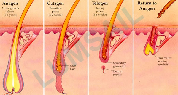 Машина удаления волос ОПТ СХР постоянная для излишних волос на лице/волос тела людей