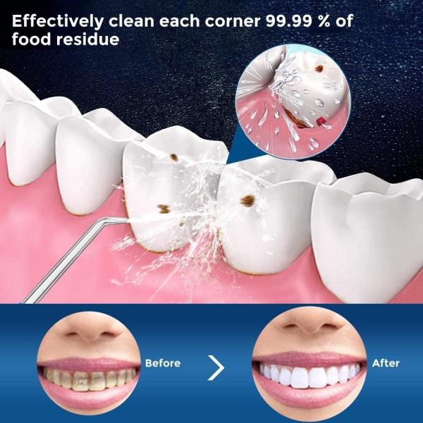 Commercial Electric Dental Spa Water Flosser 1200-1400 Times/Min Frequency