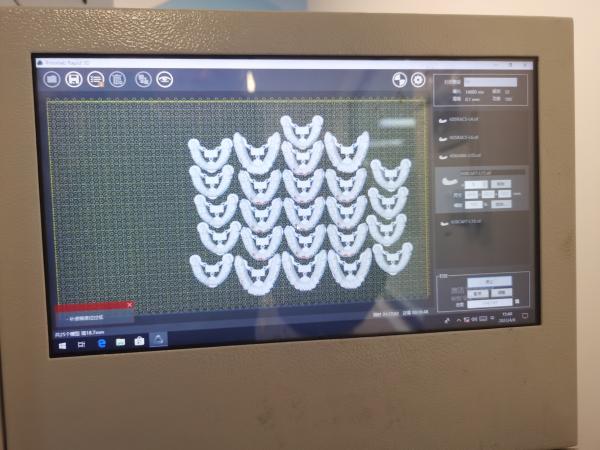 Automatic Adding Resin High Precision 3D Printer Orthodontic Model
