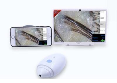 Digital Handheld Dermatoscope Video Skin Analyzer Resolution of 1080P with Internal Lithium Battery