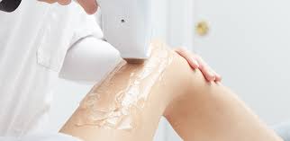 la fibre 600W a couplé l'épilation permanente de laser de diode de la Manche de laser Epolitor de la diode 808nm non