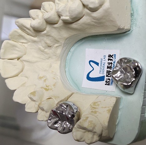 Full Cast Base Metal Alloys Dental Crown