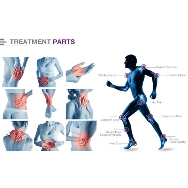Fast Body Pain Release Focused Shockwave Therapy Machine For ED Treatment