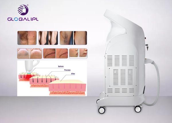 FDA Approved Diode Laser Alexandrite Hair Removal Laser Machine / 808NM Hair Removal Laser Diode