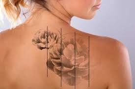 Efficient Q Switch Tattoo Removal Machine Laser Tattoo Removal Equipment 1 - 10Hz Frequency