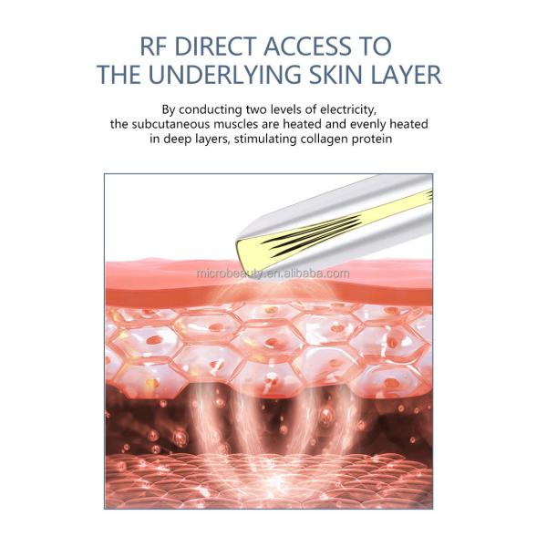 Home Eye Lift Wand Wrinkle Remove EMS Radio Frequency Red Light Therapy Eye Massage Wand