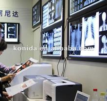 35cm x 43cm Medical Dry Imaging Film , Transparency Chest X-ray Film