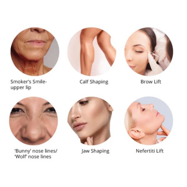 Enrugamentos Botulinum da injeção 100iu da toxina de Hyamely anti