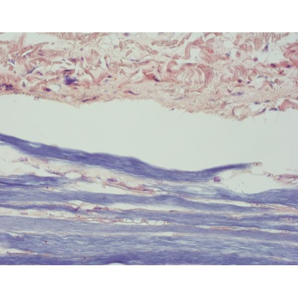 Clear Colourful Phosphotungstic Acid Hematoxylin Stain For Hospital Clinic