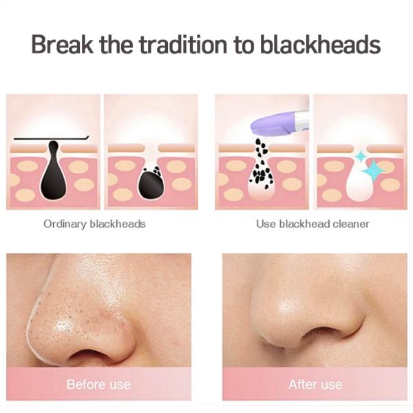 Double-Headed Product Soft Facial Wash Cleanser Silicone Face Mask Brush