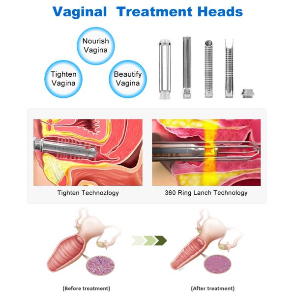 BV13 Portable Co2 Fractional Laser 60W Co2 Fraccionado Laser Vaginal Tightening Co2 Laser Machine For Skin