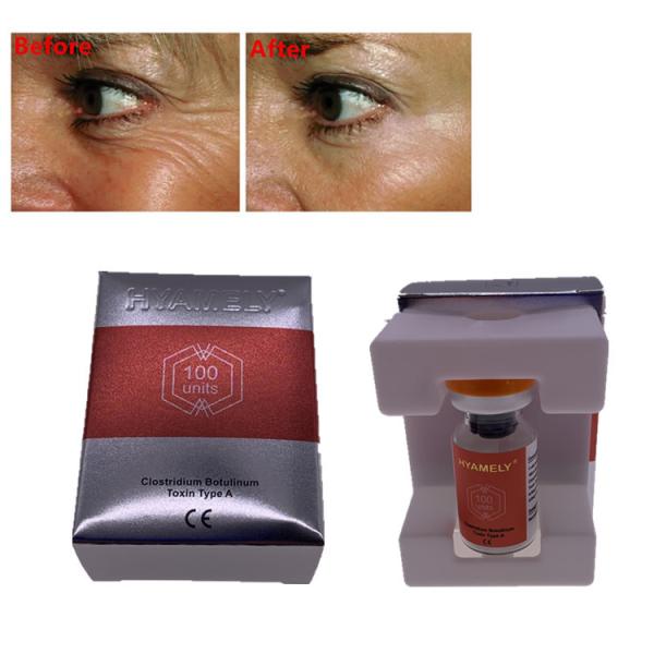 Anti Aging Hyamely  Injections For Face Wrinkles
