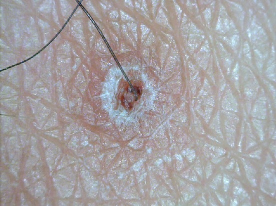 25X-200X USB Digital Microscope KLN-J200