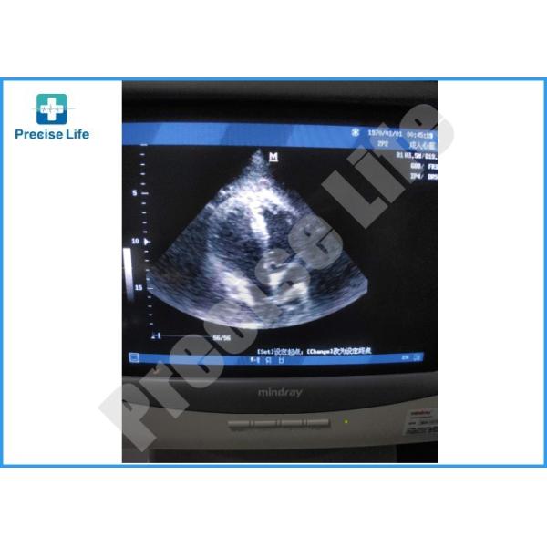 Фазированное Mindray 2P2 - оденьте зонд датчика ультразвука для сердечного/педиатрического