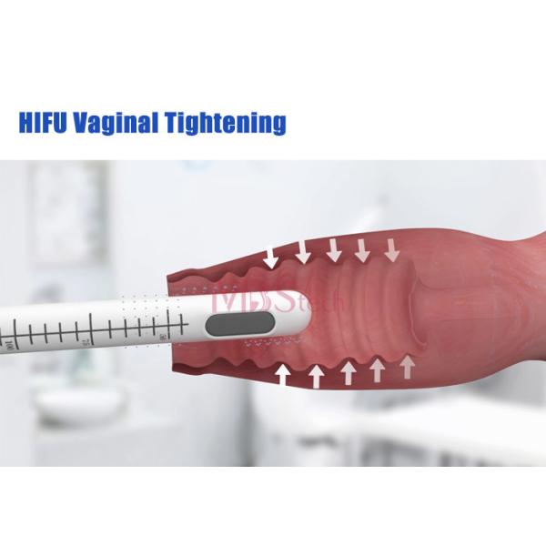 Vaginal Tightening HIFU Facial Machine