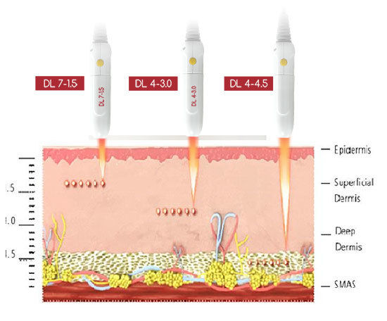 9 In 1 Multifunctional Beauty Machine 1064nm 532nm 1320nm Yag Laser