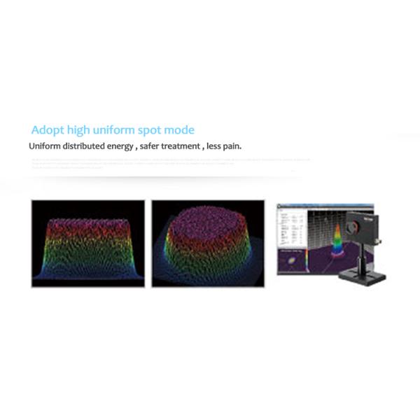 Nd Yag Laser Tattoo Removal Machine