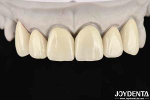 6.0-6.1 G/cm3 Density Layered Zirconia For High Translucency In CAD / CAM