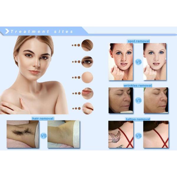 Medical OPT SHR Machine Aesthetic Beauty Salon Devices ROHS Certification