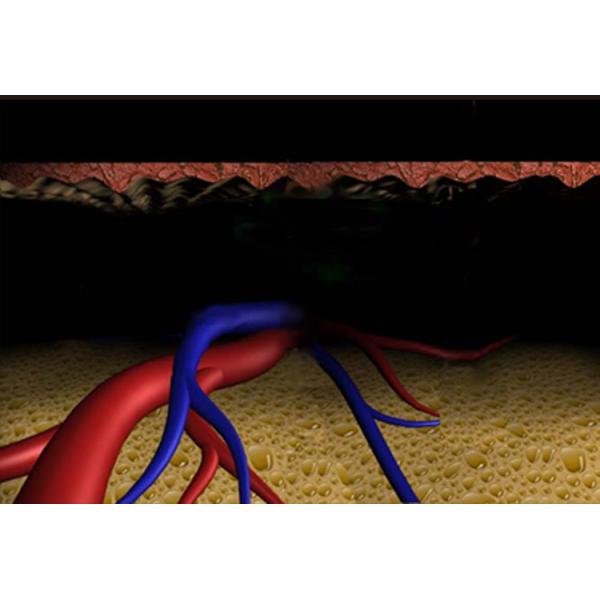 Med - 808 Portable Home Diode Laser Hair Removal Machine Lightweight Size