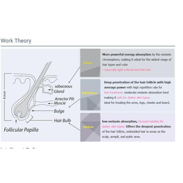 755 808 1064nm laser diode laser hair removal machine with Big spt size 23x23mm