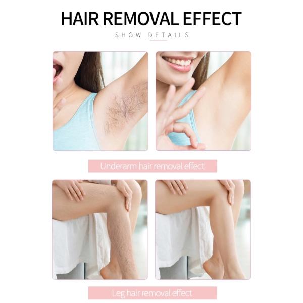 NO Q-Switch 808nm Diode Laser Hair Removal Machine for Medical Aesthetic Treatment