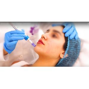 Женщины кожа заполнителя ХА не соединенная крестом дермальная глубоко ремонтируя решение