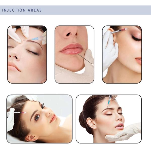 24mg/Ml Cross Linked Hyaluronic Acid Gel Injection