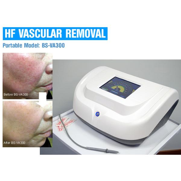Машина удаления высокочастотной красной крови васкулярная с ИМПом ульс/непрерывн