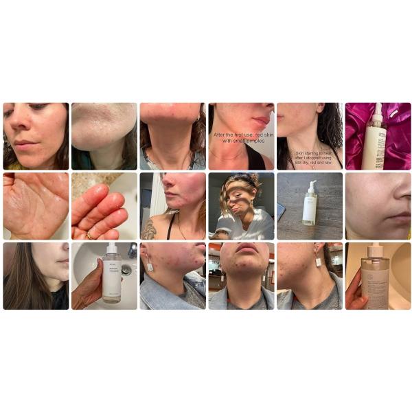 ODM Heartleaf Pore Control Moisturizing Facial Cleanser Oil For Face Makeup Blackhead Remover 6.76 Fl Oz