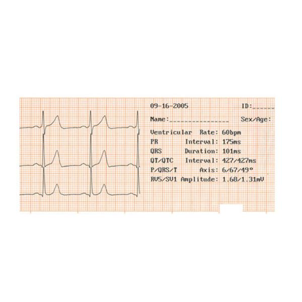Electric Multi Panel Portable ECG Machine 6 Channel