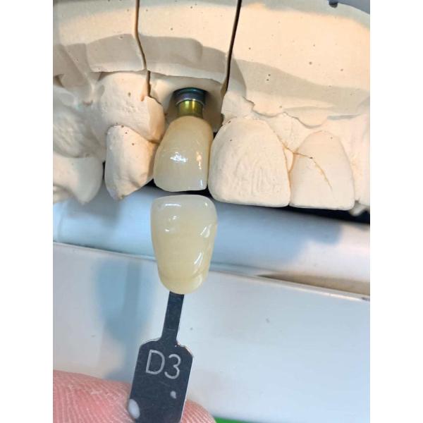 прочность окиси циркония блока Zirconia HT 1200MPa зубоврачебная высокая Flexural