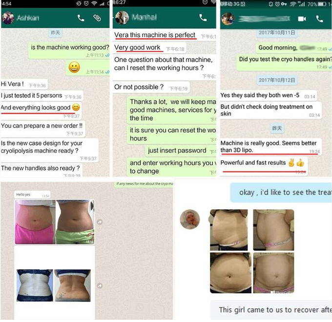 Потеря веса bodyshape RF вакуума уменьшая уменьшение целлюлита машины