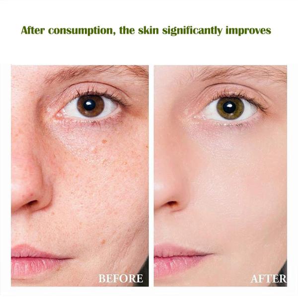 Men's & Women's Health Gummies – Lime Flavor with Chlorophyll, Apple Cider Vinegar, Pineapple Enzyme & Probiotics