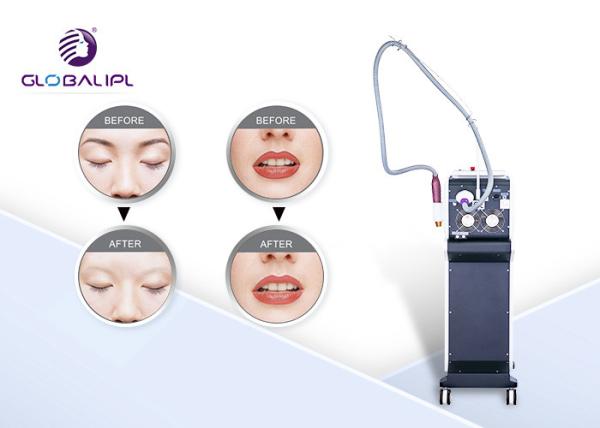 Máquina da remoção da tatuagem do laser do interruptor do salão de beleza Q, tratamento 1500W do laser do interruptor de Q