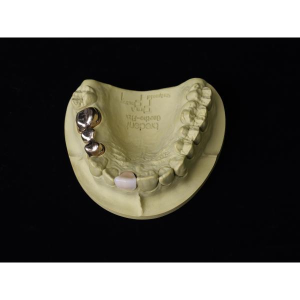 Audental 22 Au73.8% Cerámica Dental amarilla de aleación de aleaciones altas y nobles Odontología