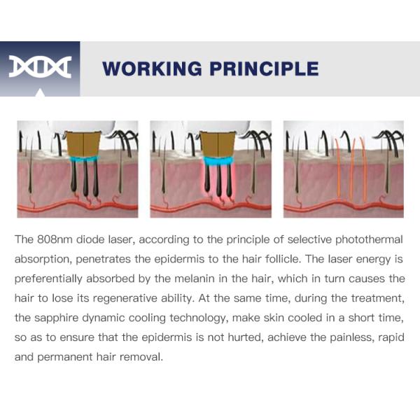 AS31Wholesale Diode Laser Beauty Machine 600W 2 in 1 IPL machine OPT Laser Painless Hair Removal device for salon beauty