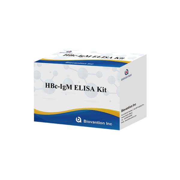 ISO13485 HBc IgM Test Kit Hepatitis B Core Antibody Igm Test
