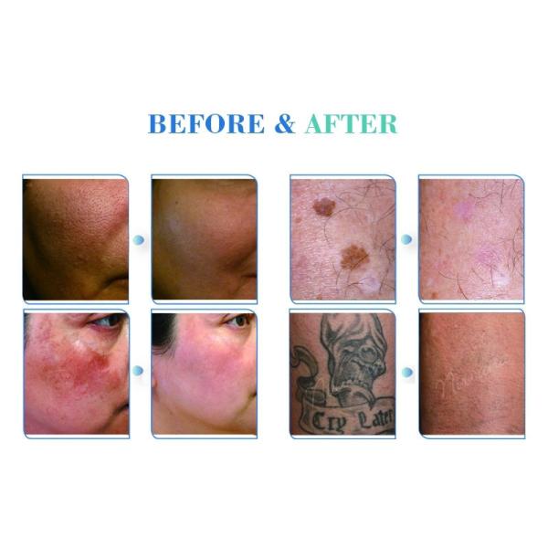 Два стержня 2700 Вт Пикосекундная лазерная машина с длиной волны 1064nm/532nm/1320nm/755nm